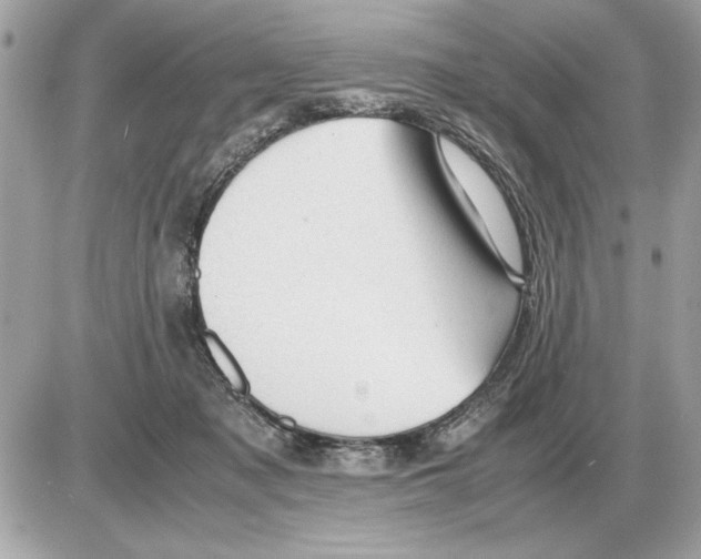 X0000085270317200704092146