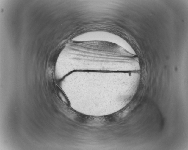 X0000085270329200704092146