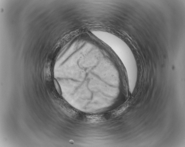 X0000085270516200704092143