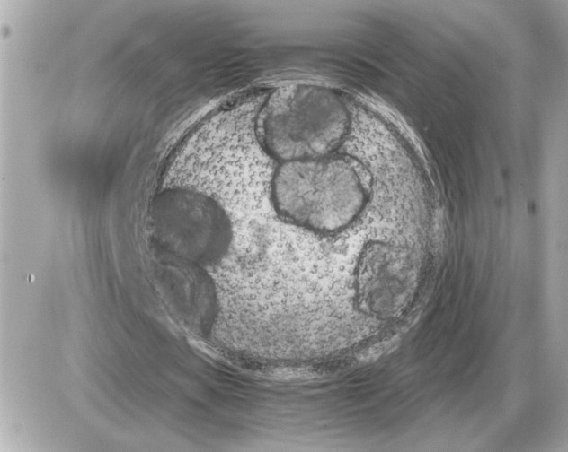 X0000085270529200704092142