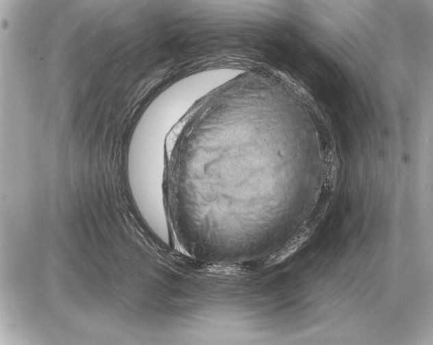 X0000085270762200704092140