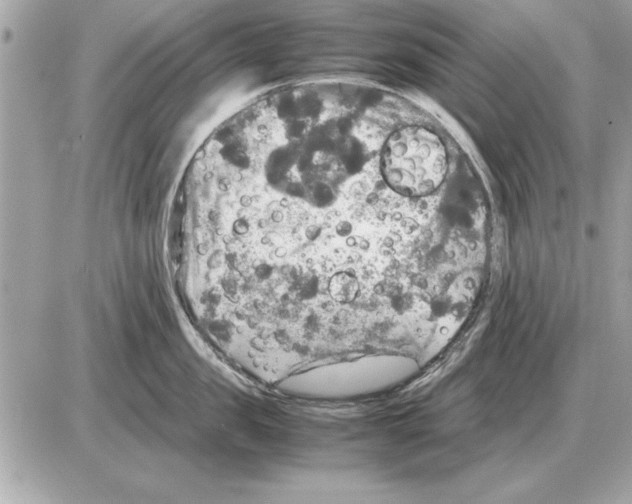 X0000085270957200704092137