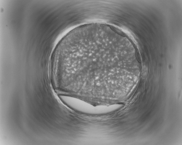 X0000085271295200704092130