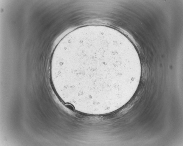 X0000085271387200704092129