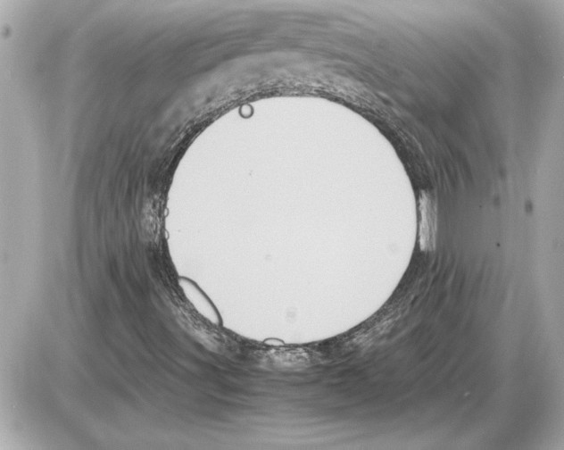 X0000085271491200704092126