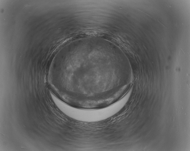 X0000085281106200703091410