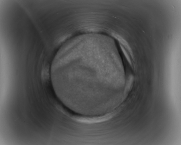 X0000085280017200703301926