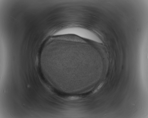 X0000085280158200703301923