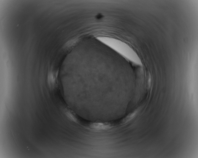 X0000085280239200703301923