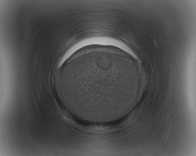 X0000085280264200703301922