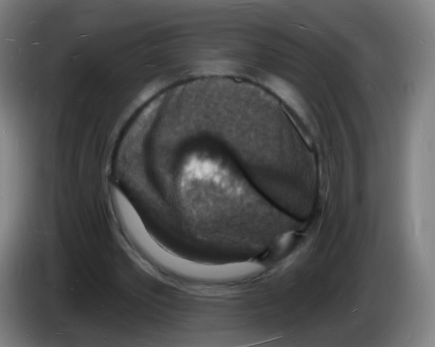 X0000085280389200703301920