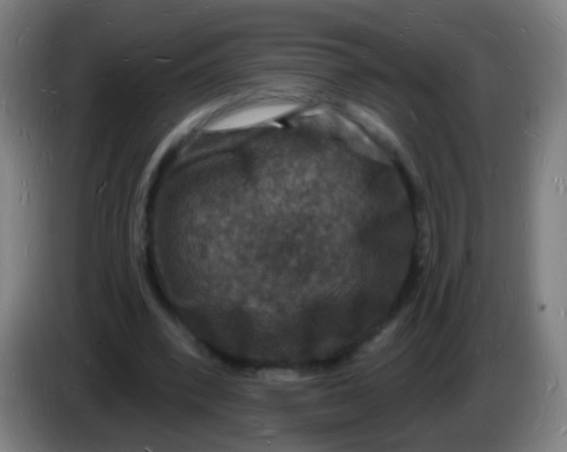 X0000085280392200703301920