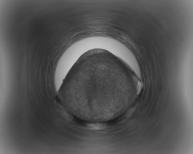 X0000085280417200703301920