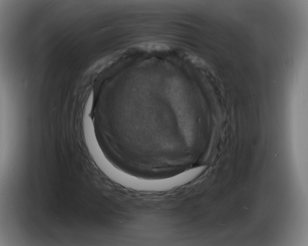 X0000085281014200703301911