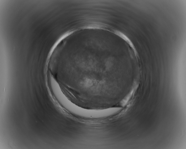 X0000085281138200703301910