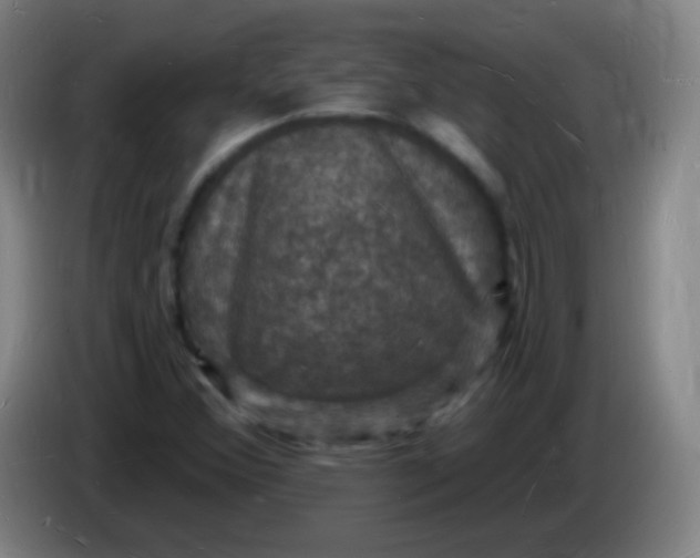 X0000085281356200703301907