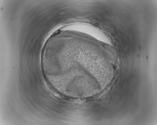 X0000085280148200704092215