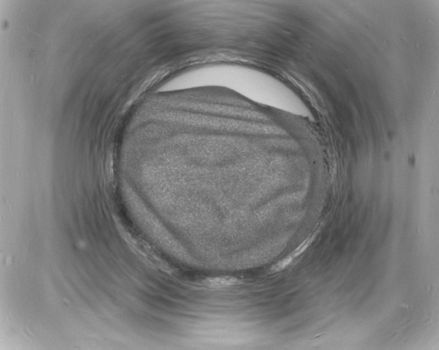 X0000085280158200704092215