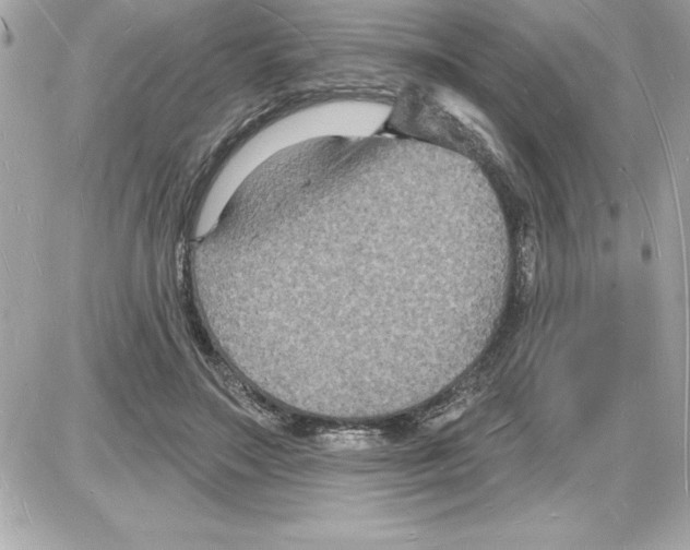 X0000085280499200704092210