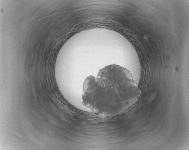 X0000085280772200704092205