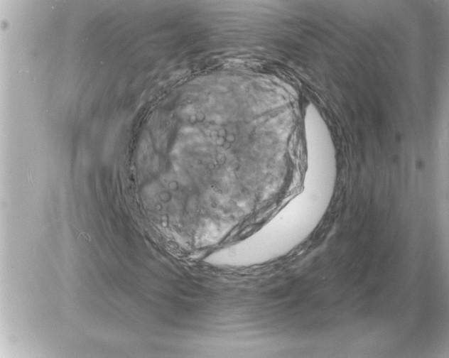 X0000085280913200704092202