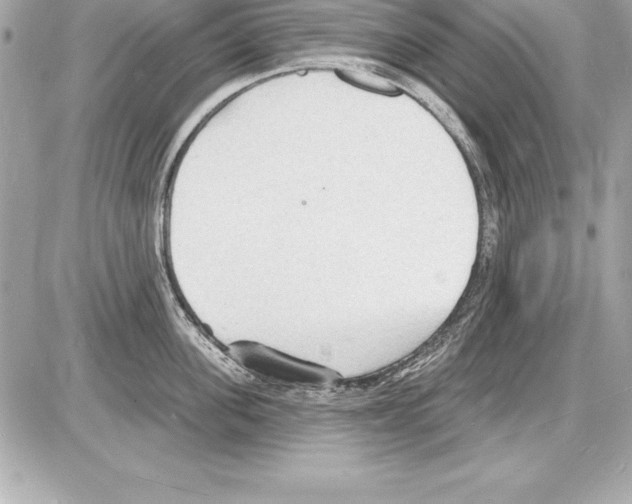 X0000085280955200704092203