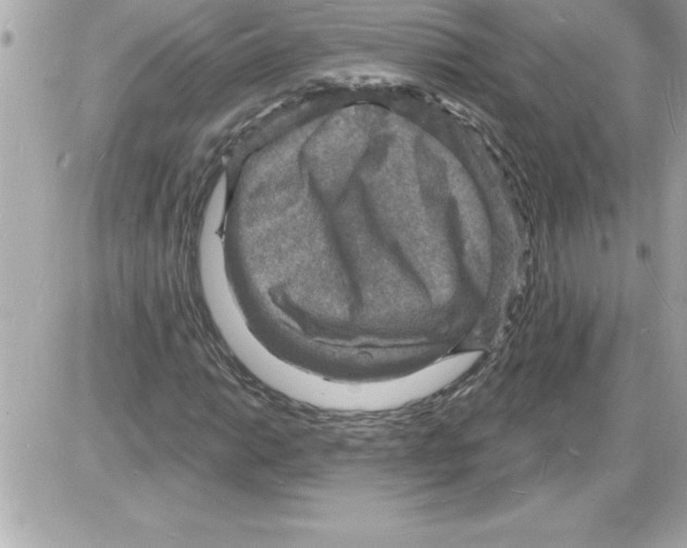 X0000085281014200704092200