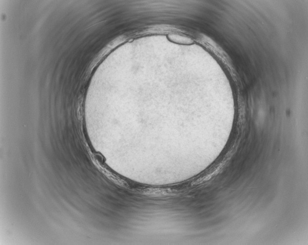 X0000085281049200704092201