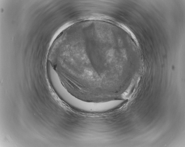 X0000085281138200704092159