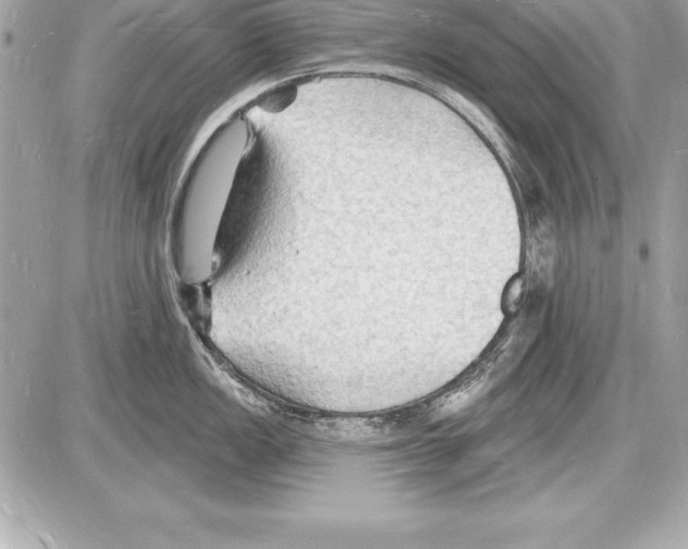 X0000085281149200704092159