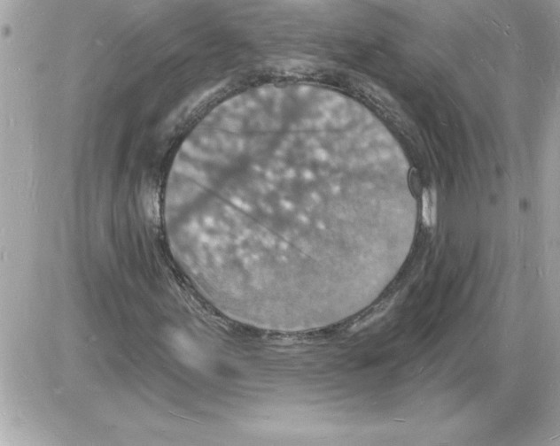 X0000085281155200704092159