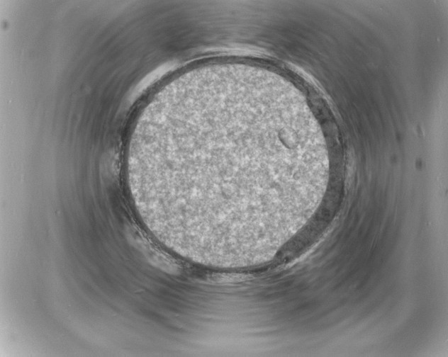 X0000085281163200704092158