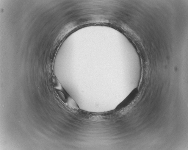 X0000085281169200704092158