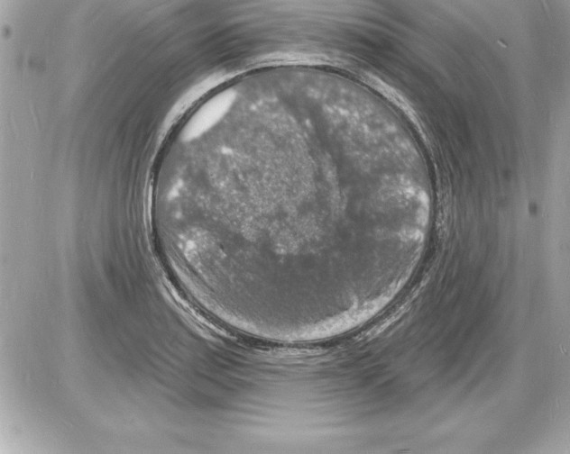 X0000085281179200704092158