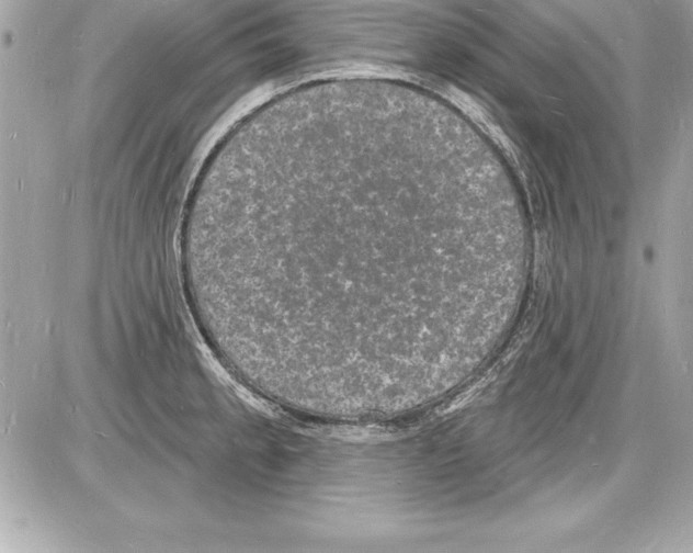 X0000085281189200704092158