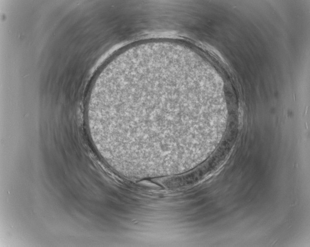 X0000085281212200704092157