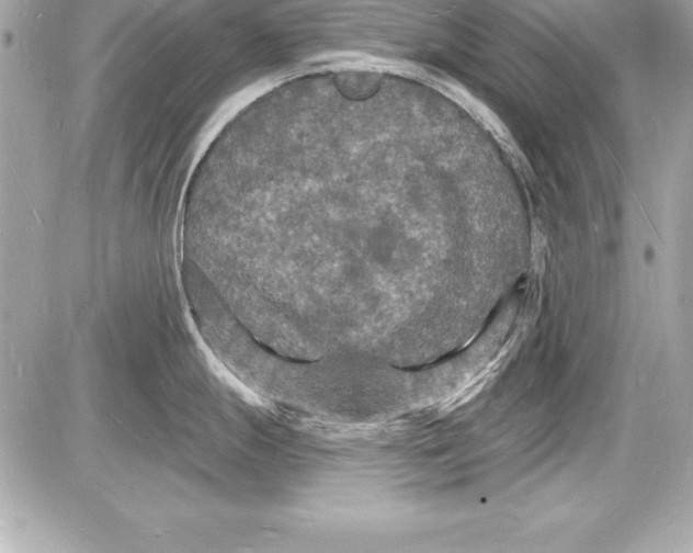 X0000085281247200704092158