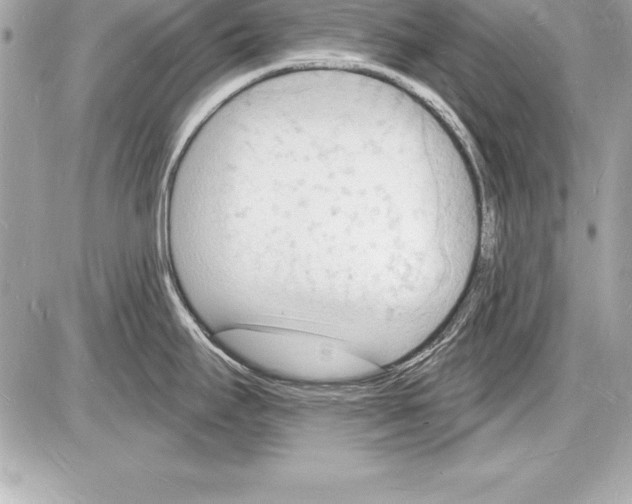 X0000085281295200704092156