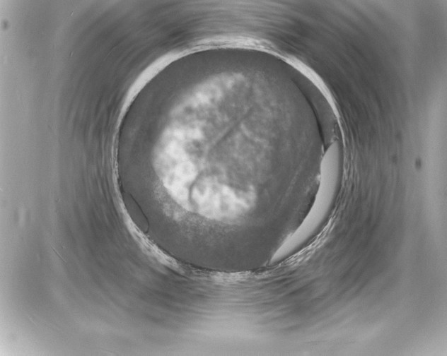 X0000085281389200704092155