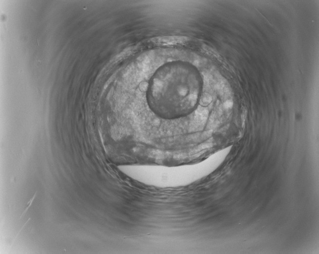 X0000085281393200704092154