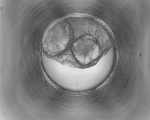 X0000085281417200704092154