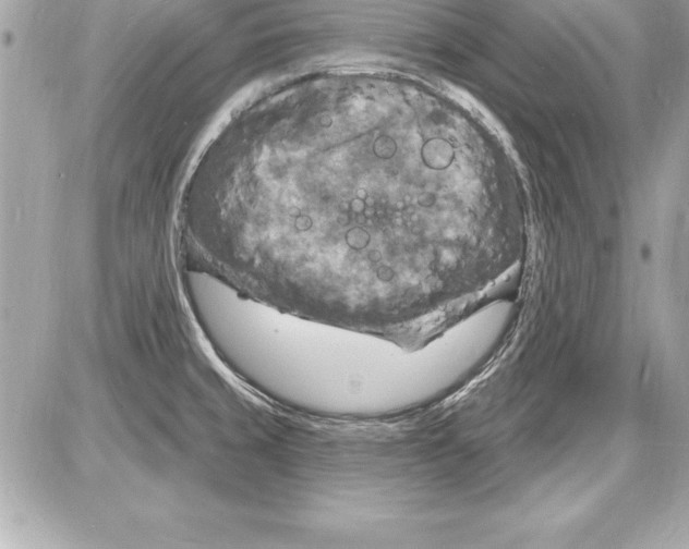 X0000085281429200704092154