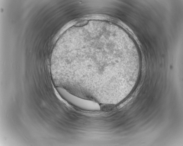 X0000085281433200704092155