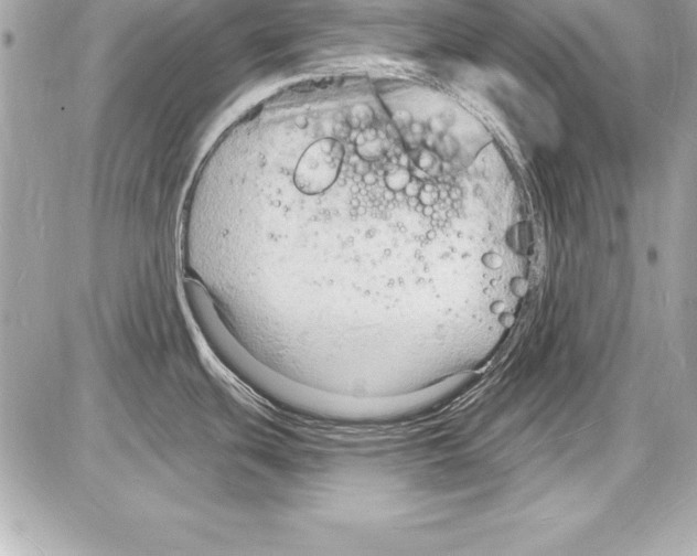 X0000085281439200704092155