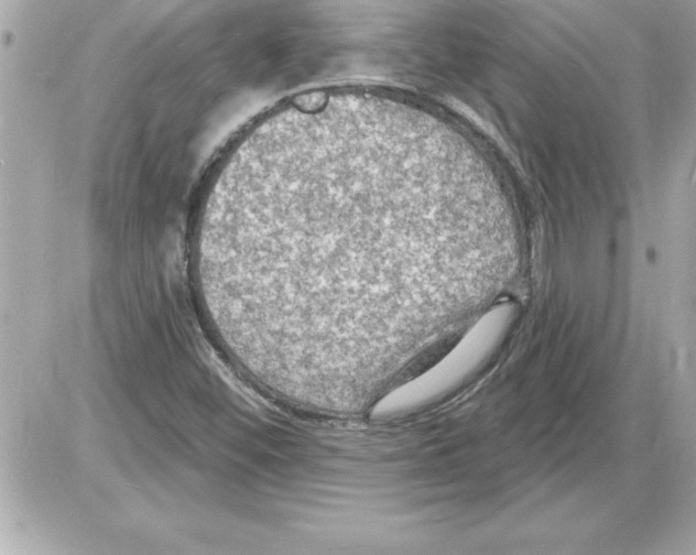 X0000085281452200704092154