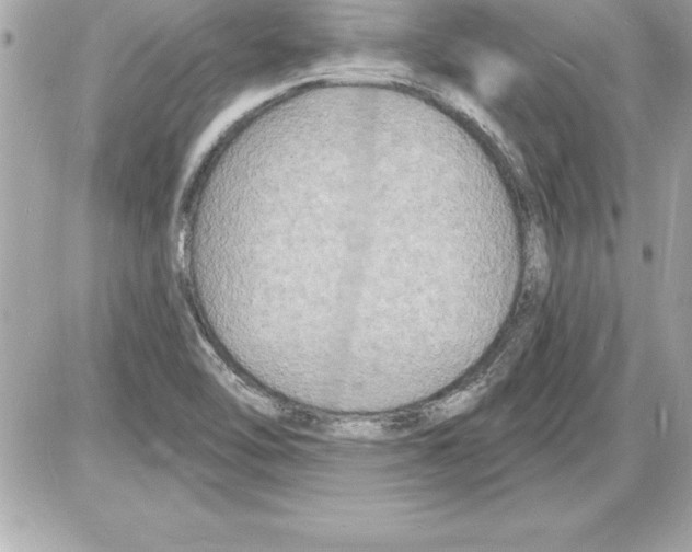 X0000085281462200704092154