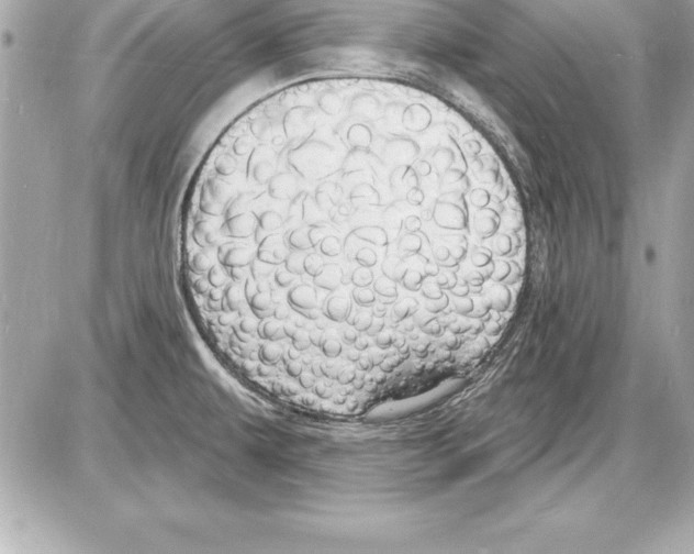 X0000085281479200704092153