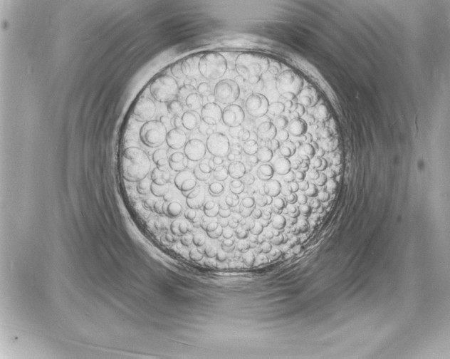 X0000085281483200704092153