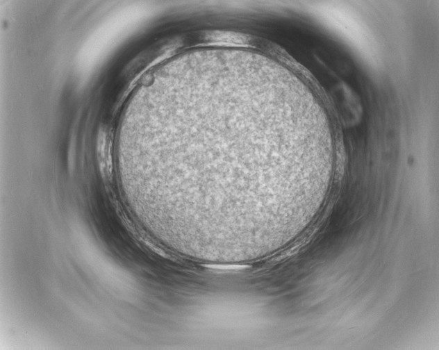 X0000085281487200704092153