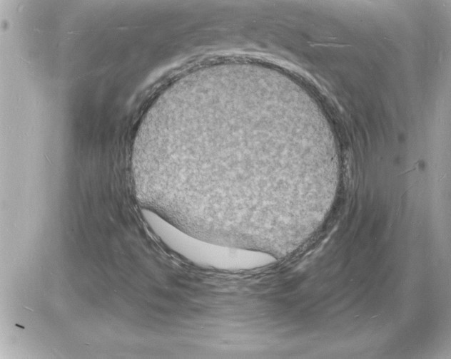 X0000085281494200704092152